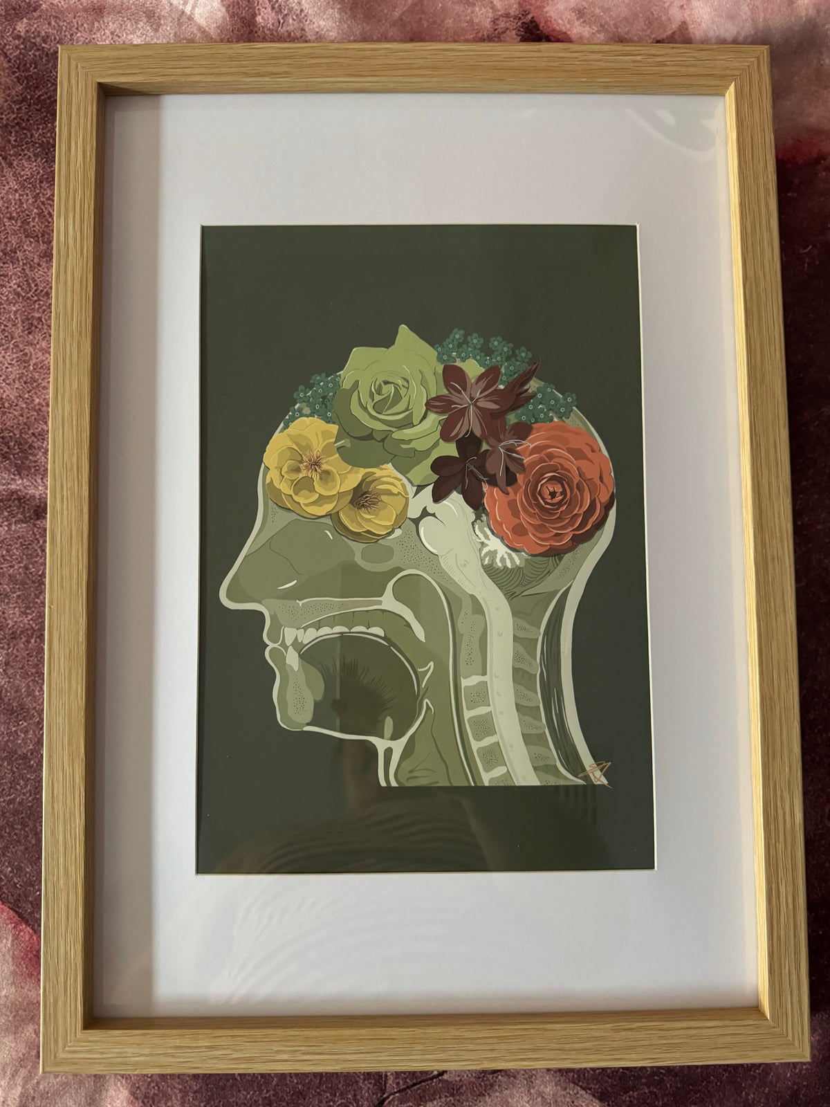 Vital Designs Anatomy Art Print Beautiful Mind- Framed