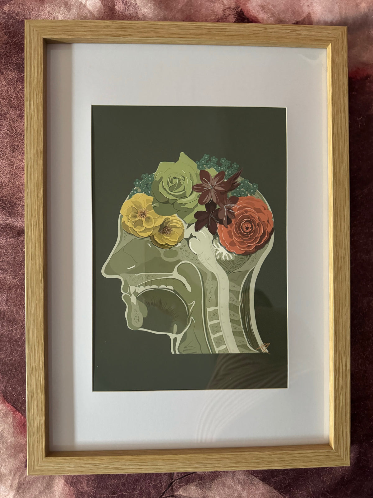 Vital Designs Anatomy Art Print Beautiful Mind- Framed